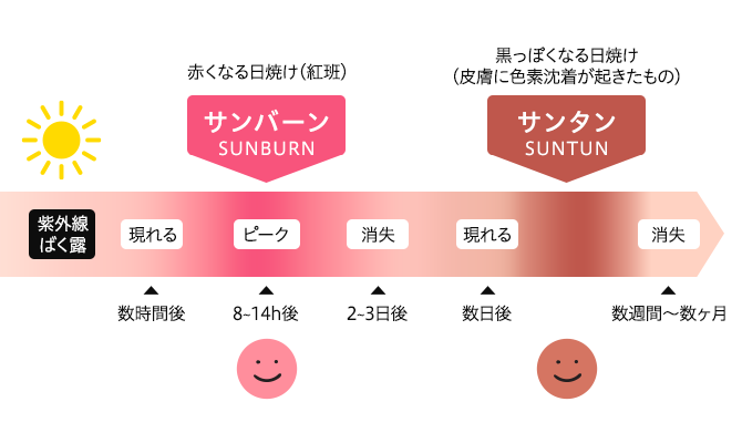 「サンバーン」と「サンタン」について