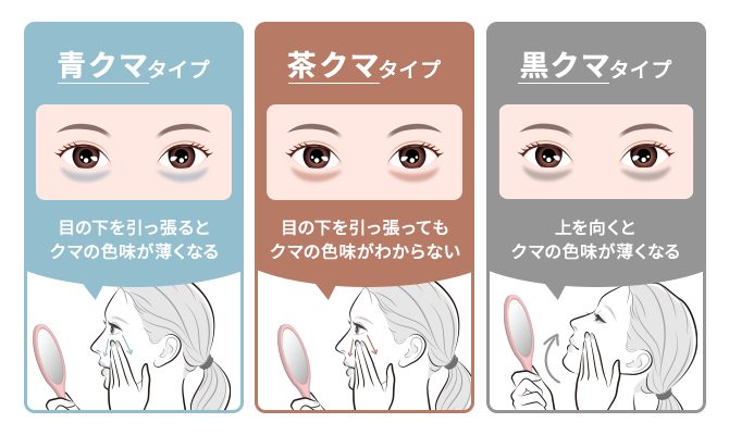 クマの種類