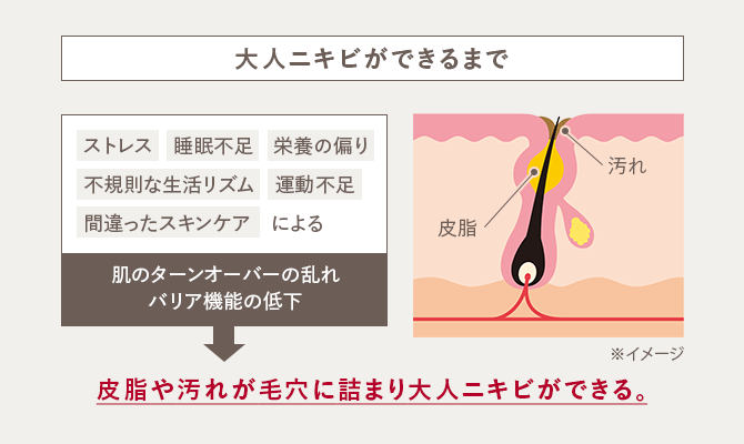 大人ニキビができるまでの図