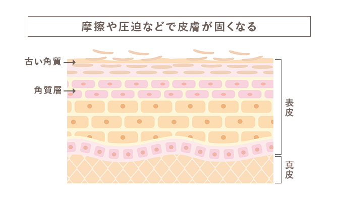 スクラブ入りの洗浄剤でひじをマッサージ