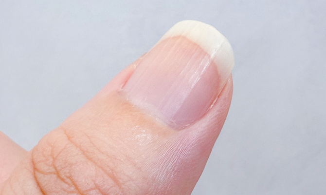 ズームアップした爪の写真