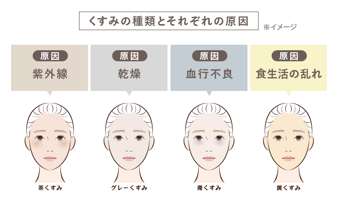 くすみの種類とそれぞれの原因 ※イメージ　・茶くすみ（原因：紫外線）・グレーくすみ（原因：乾燥）・青くすみ（原因：血行不良）・黄くすみ（原因：食生活の乱れ）