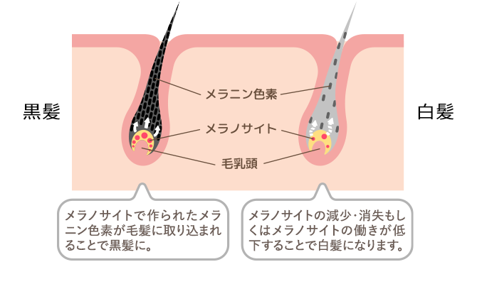 黒髪：メラノサイトで作られたメラニン色素が毛髪に取り込まれることで黒髪に。白髪：メラノサイトの減少・消失もしくはメラノサイトの働きが低下することで白髪になります。