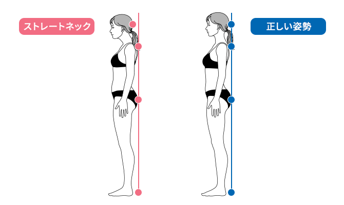 ストレートネックと正しい姿勢