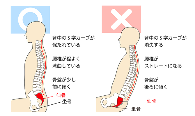 良い姿勢と悪い姿勢の比較図